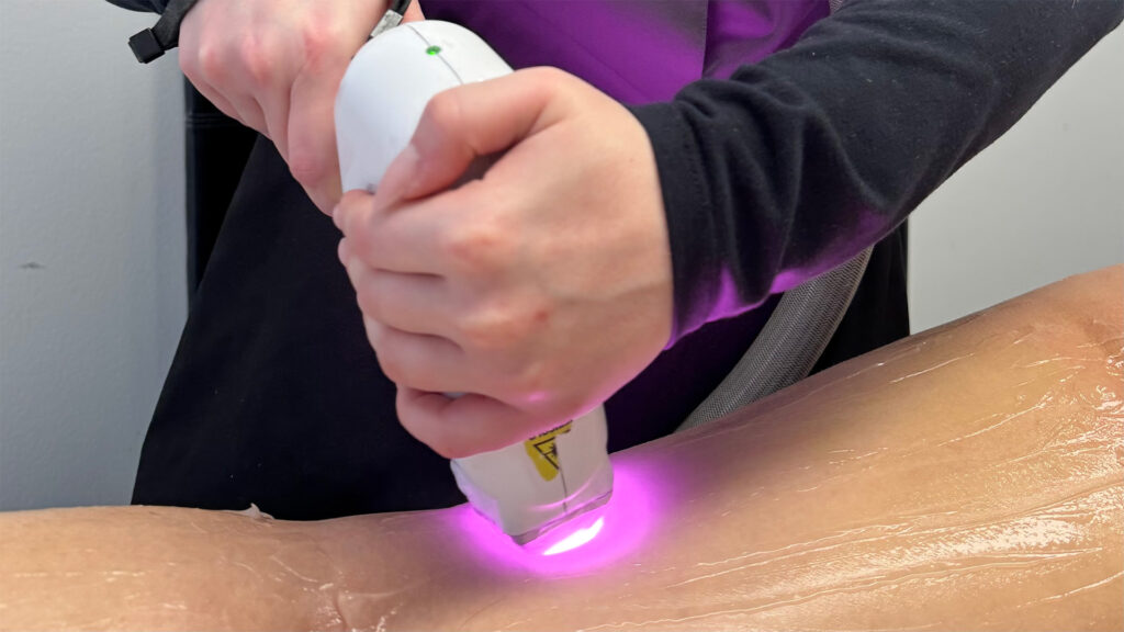 LA DOLCE VITA centro estetico trattamento laser